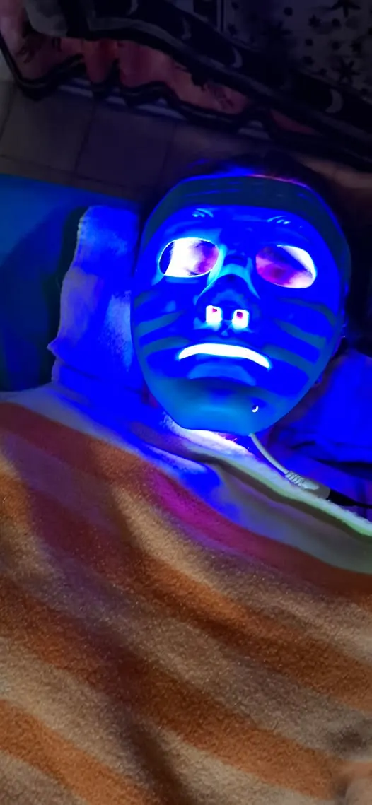 Aplicación de mascarilla facial con técnica de acupuntura
